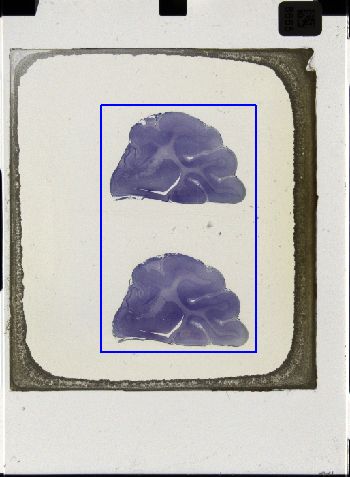 Media type: image; Special Collections 3043   shows specimen_part histological serial section;